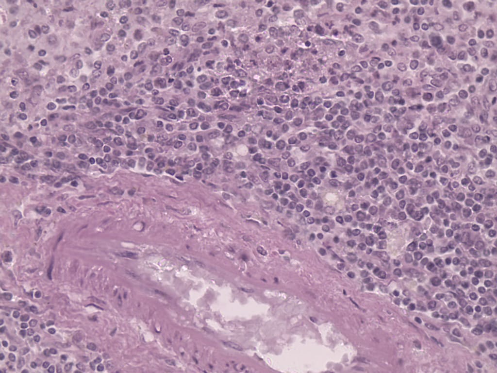 Spleen, Human Slide