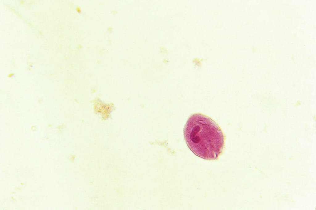 Balantidium coli, Trophozoites Slide