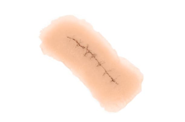 Medicor® Sticky Wounds