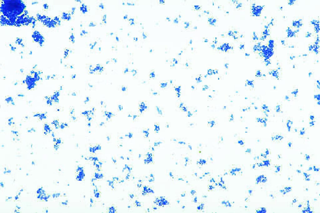 Staphylococcus aureus Slide