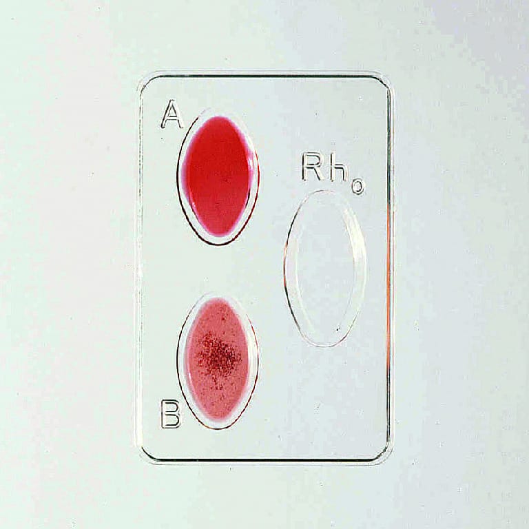 Simulated ABO Blood Typing Kit