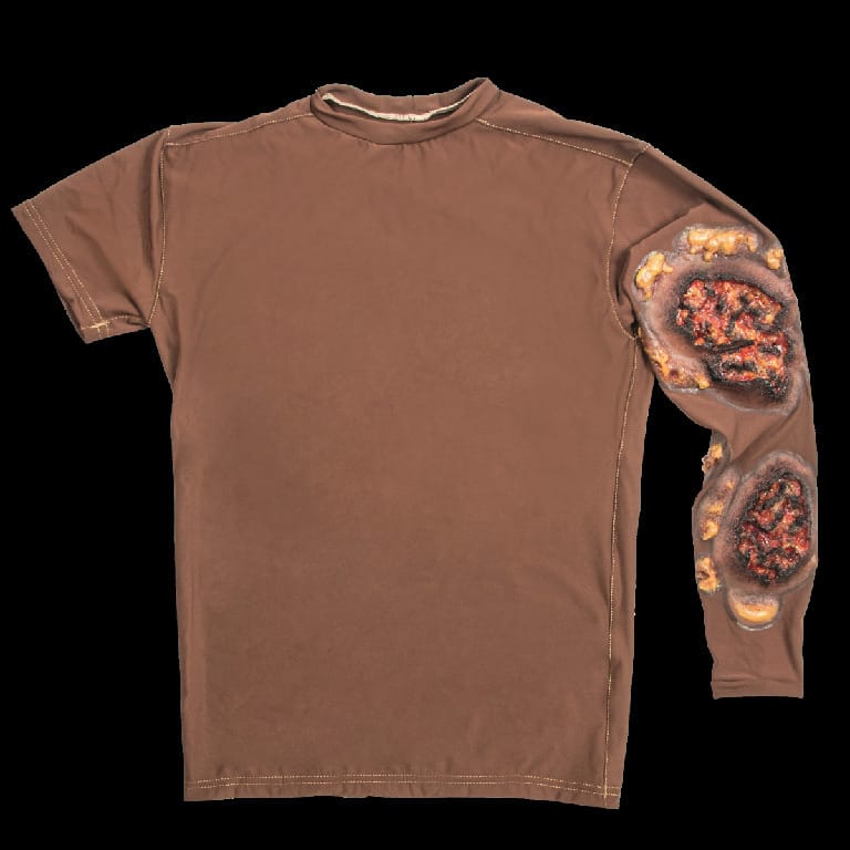 STOPS® Wound Clothing