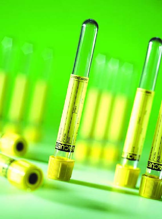 VACUETTE® Urine Tubes, Greiner Bio-One