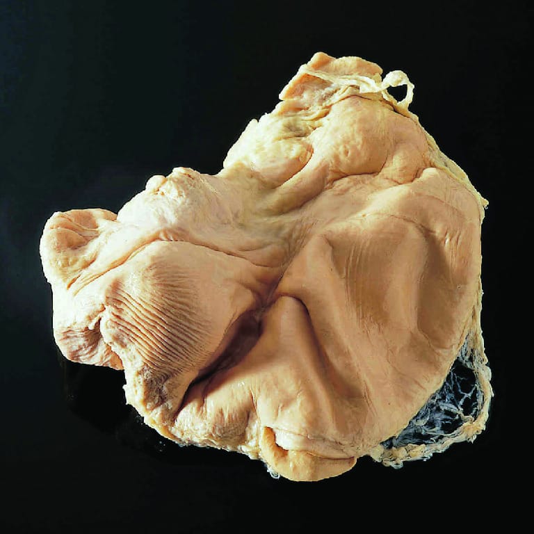 Pig Stomach