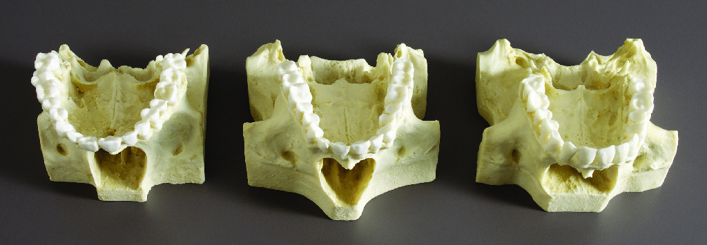 BoneClones® Comparative Maxilla Set