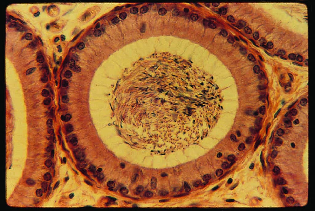 Epididymis, Primate Slide