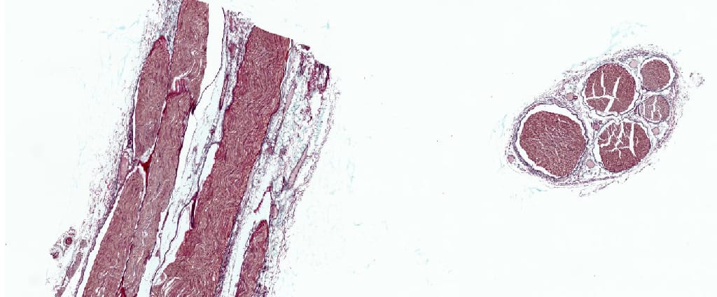 Medullated Nerve, Cross/Longitudinal Section, Masson Stained Slides