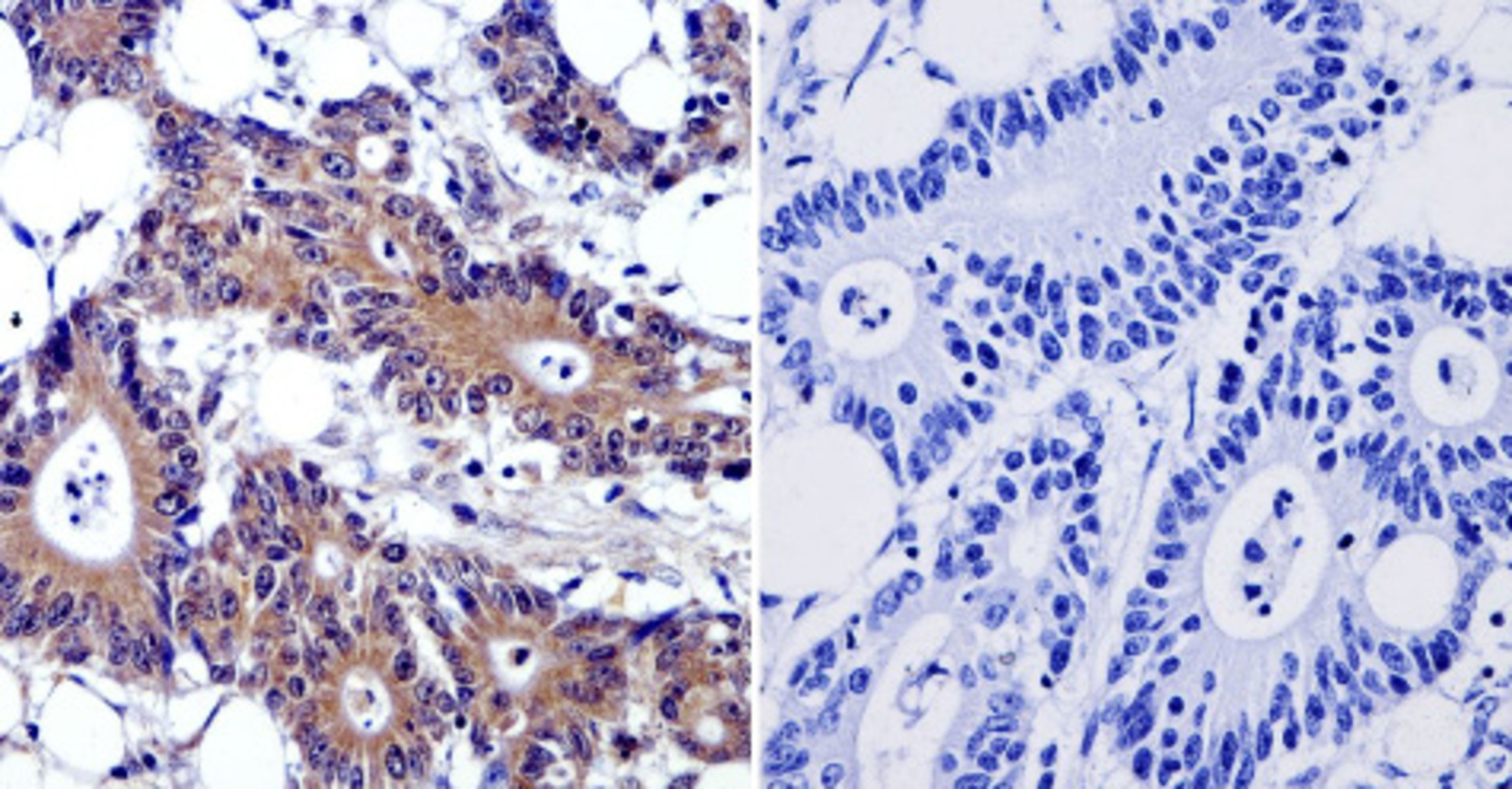 Anti-Cytohesin 2 Mouse Monoclonal Antibody [clone: 10A12] | VWR, part ...