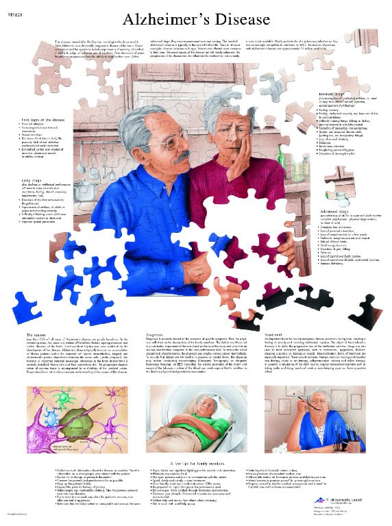 3B Scientific® Alzheimer Disease Chart