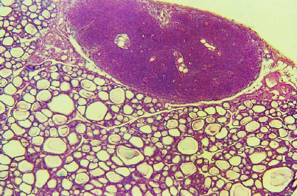 Thyroid and  Parathyroid Slide