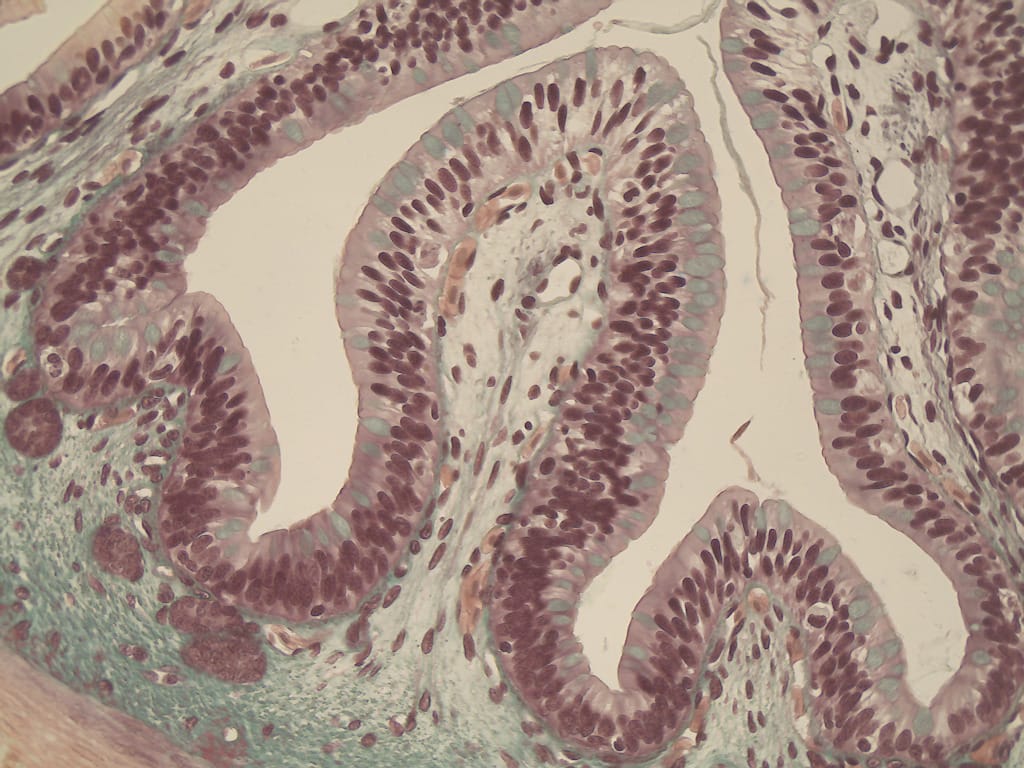 Simple Columnar Epithelium Slide