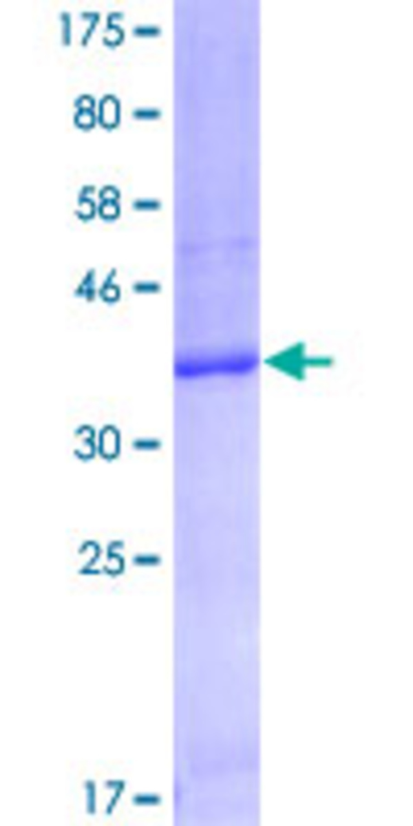 Human Recombinant FCGRT/FCRN (from Wheat germ) | VWR, part of Avantor