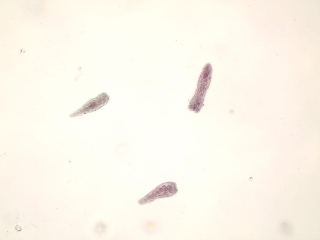 Fasciola hepatica, Miracidia Slide
