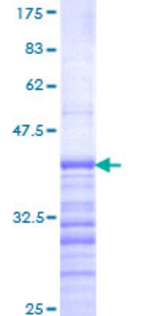 Human Recombinant Dub3 (from Wheat germ) | VWR, part of Avantor