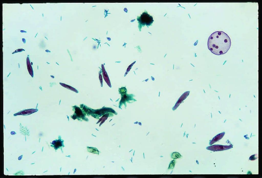 Protist Motility Slide