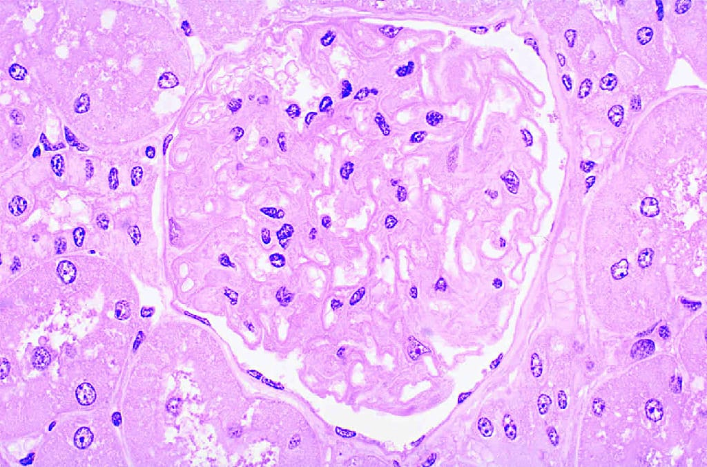 Kidney Slide