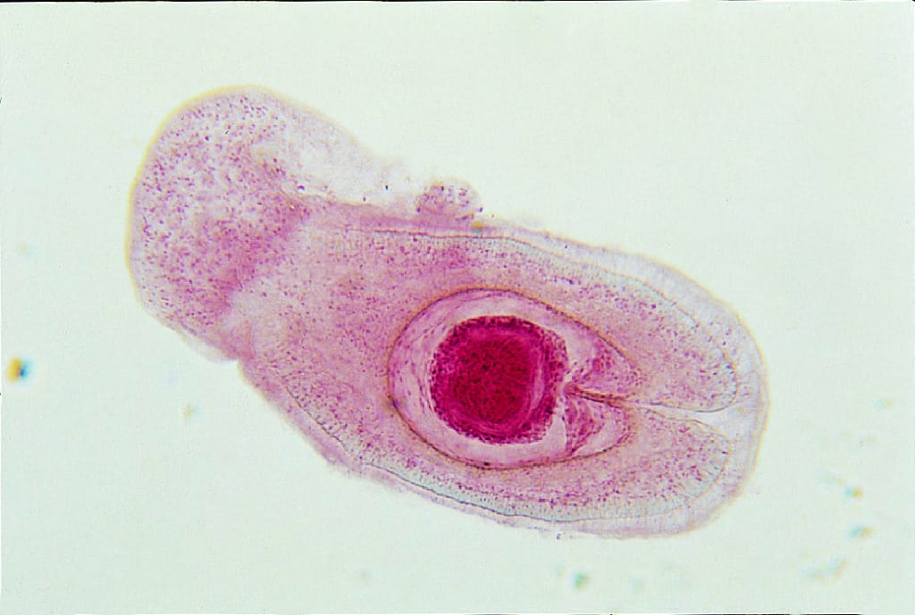 Hymenolepis sp., Cysticercoid Slide