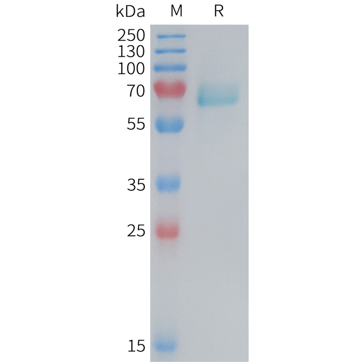 Mouse Recombinant Eph Receptor A2 (from HEK293 Cells) | VWR, part of ...
