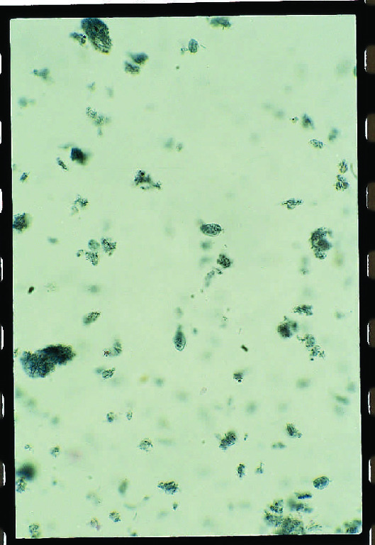 Chilomastix mesnili, Trophozoites Slide