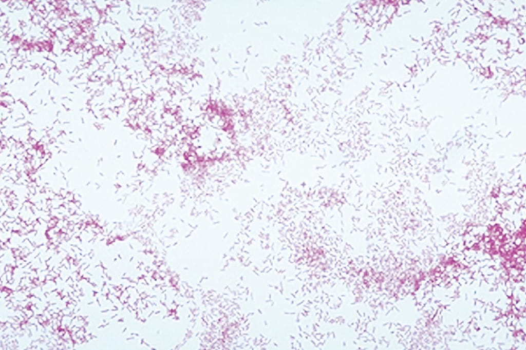 Ward's® Live Salmonella enteritidis Culture - PATHOGEN