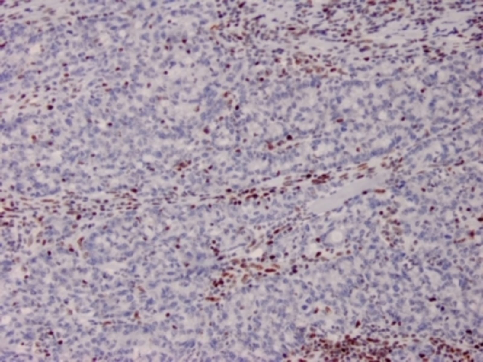 Anti-MSH2 Mouse Monoclonal Antibody [clone: MSH2/2622] | VWR, part of ...