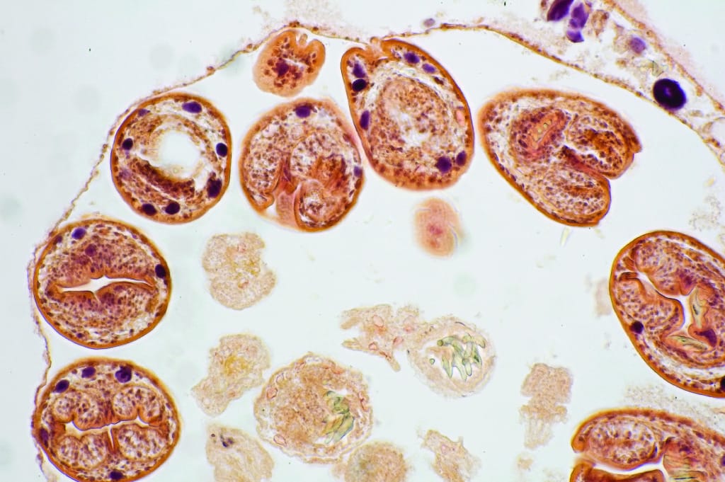 Echinococcus sp., Hydatid Cyst Slide