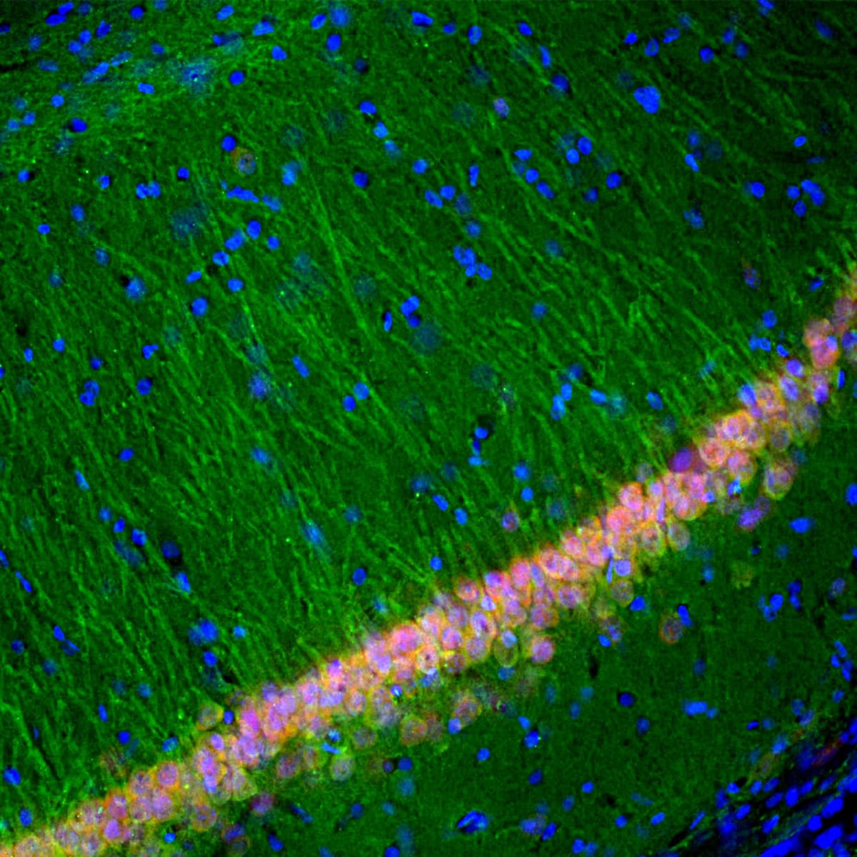 Anti-UCHL1 Mouse Monoclonal Antibody [clone: BH7] | VWR, part of Avantor