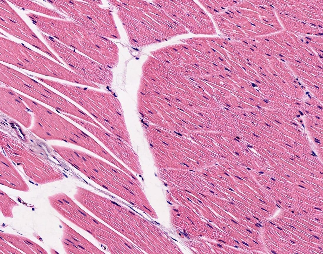 Skeletal Muscle Slide