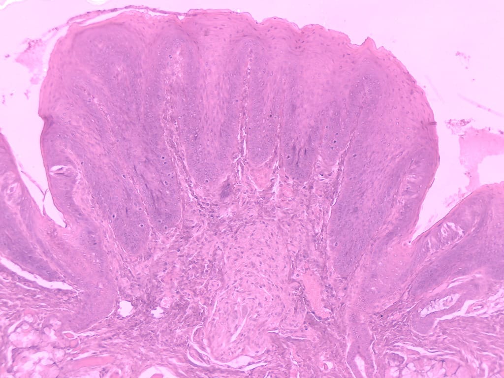 Tongue, Vallate Papillae, Mammal Slide