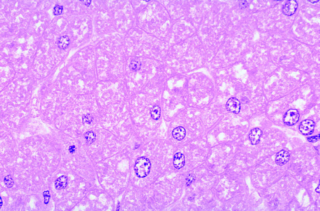 Liver Slide