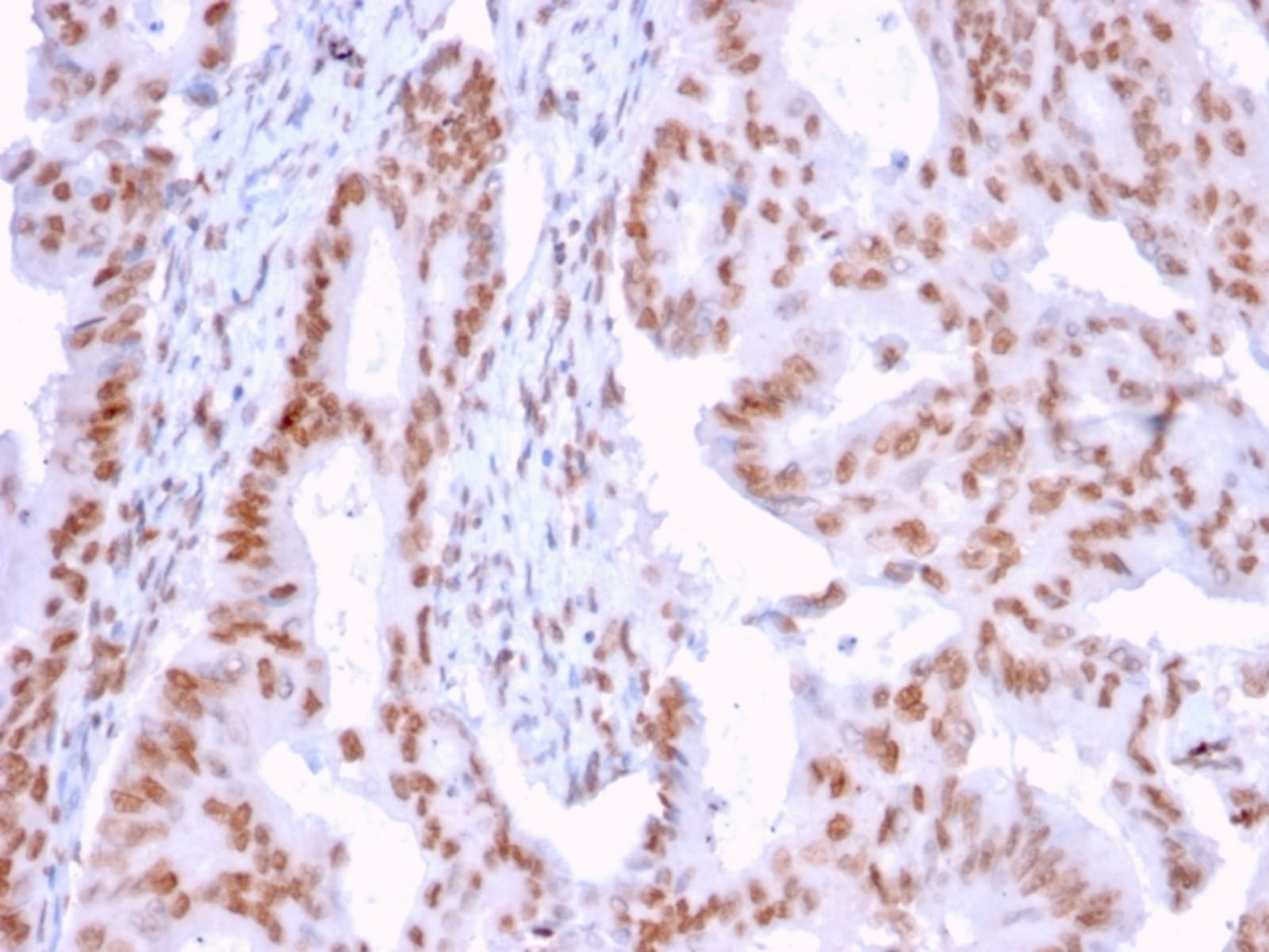 Anti-DMC1 Mouse Monoclonal Antibody [clone: 2H12/4] | VWR, part of Avantor