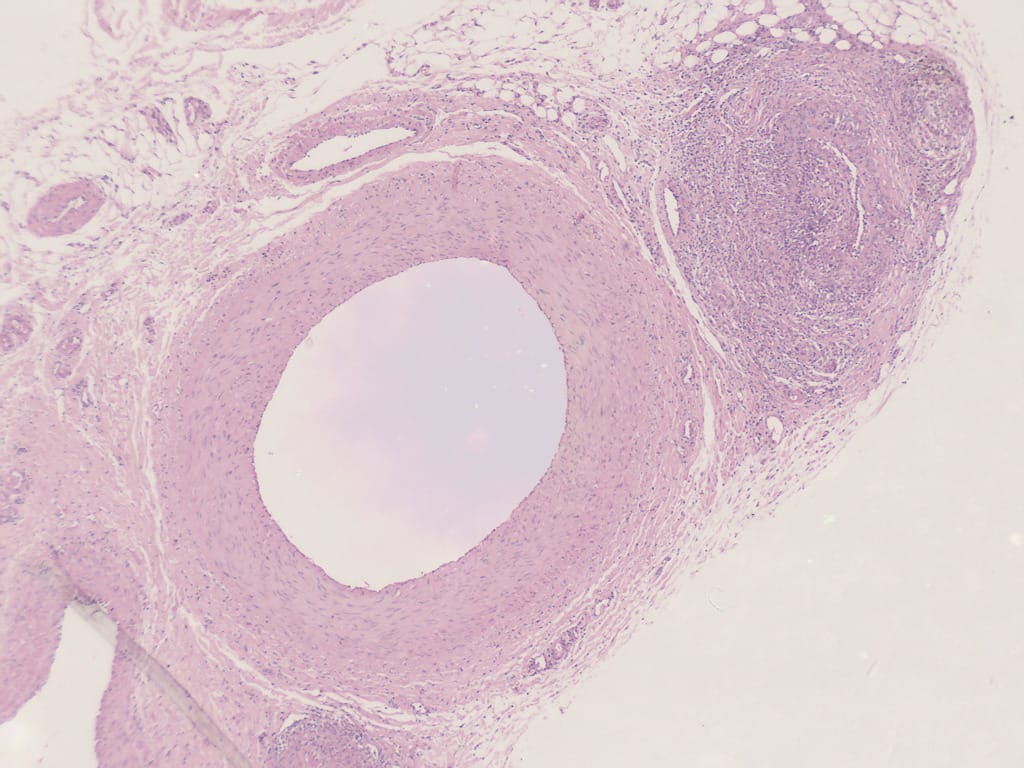 Artery, Vein and Capillary Slide