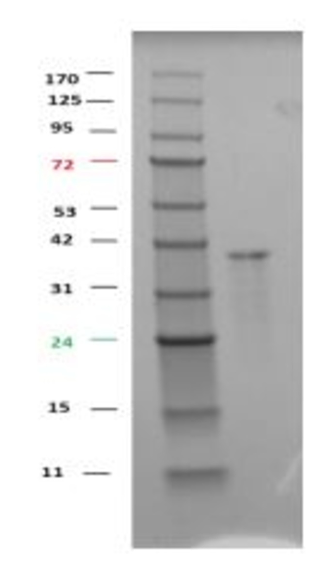 Human Recombinant GSK3 alpha (from E. coli) | VWR, part of Avantor