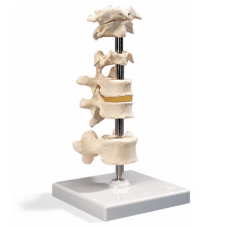 3B Scientific® 6 Vertebrae Set