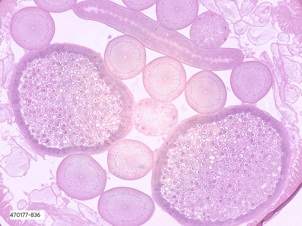 <i>Ascaris lumbricoides</i> Slide