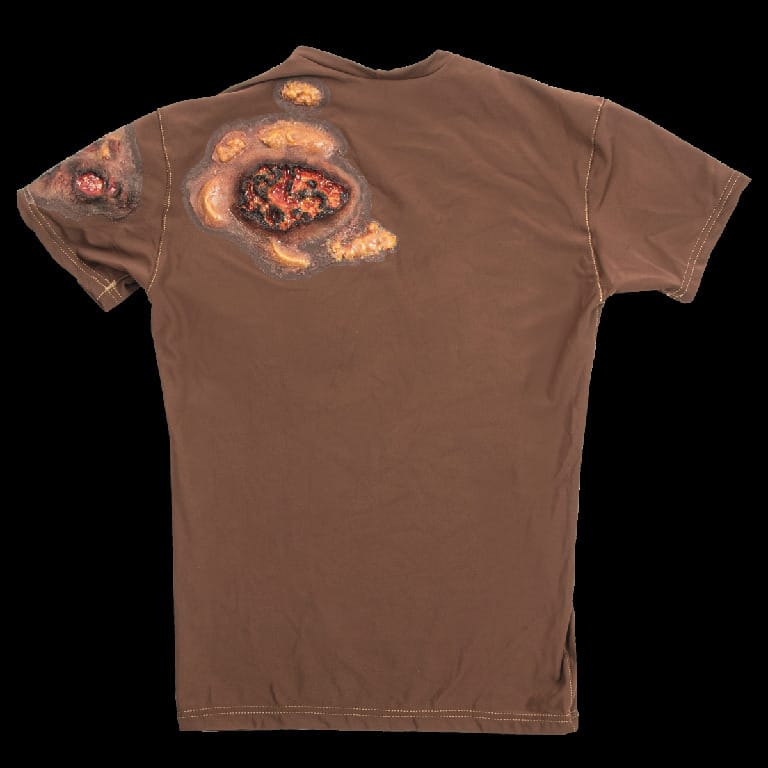 STOPS® Wound Clothing