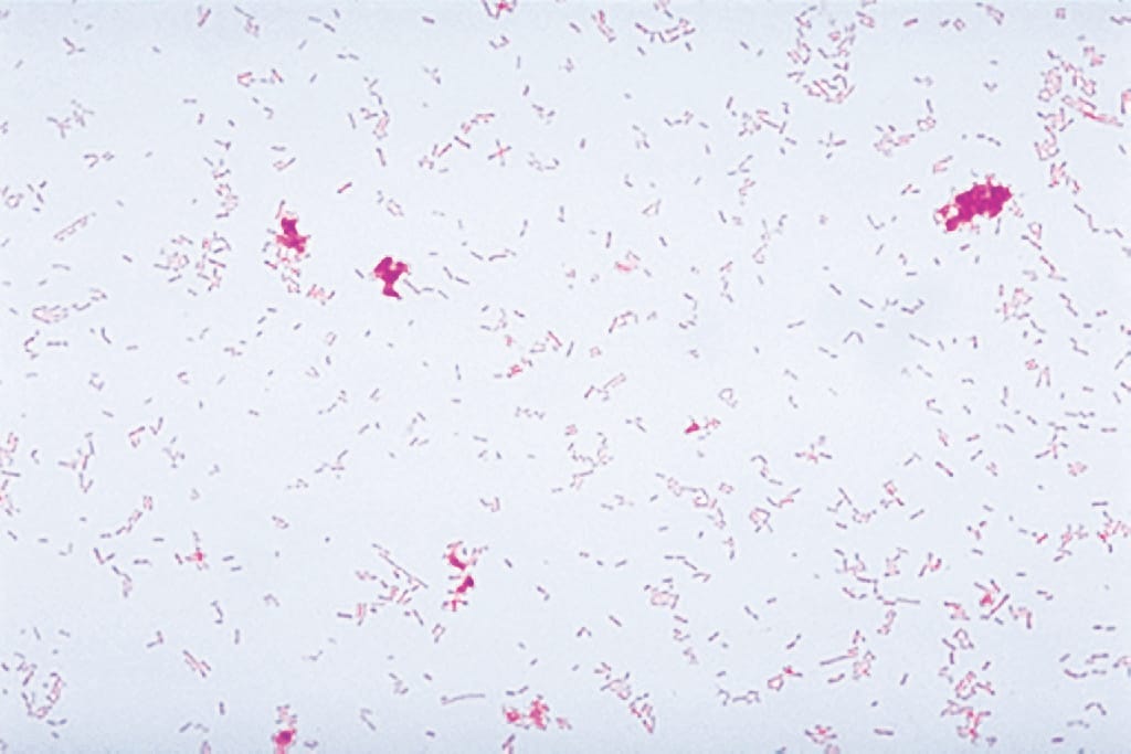 Ward's® Live Klebsiella pneumoniae Culture - PATHOGEN