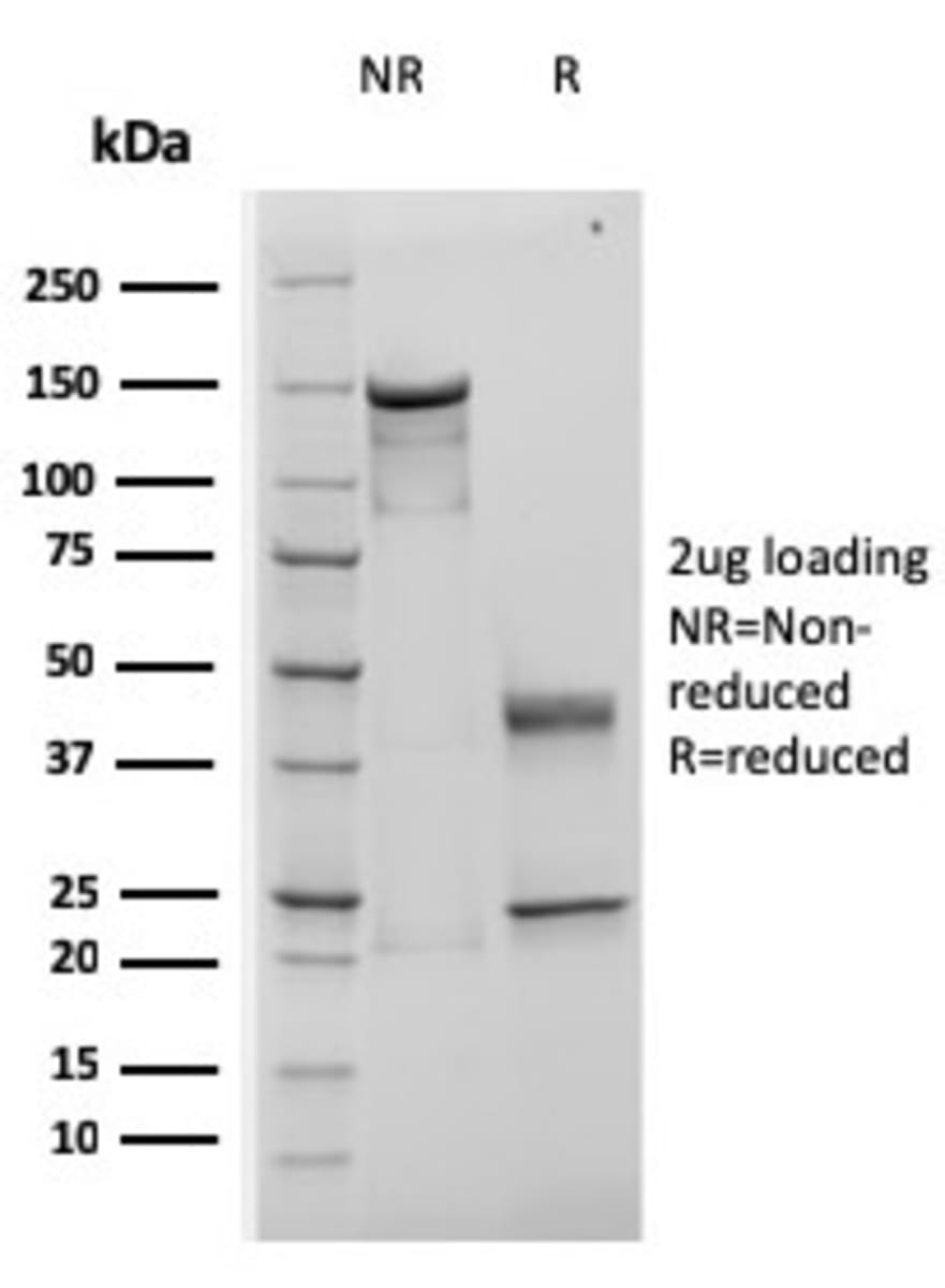 Anti-TIMP1 Mouse Recombinant Antibody [clone: rTIMP1/1710] | VWR, part ...