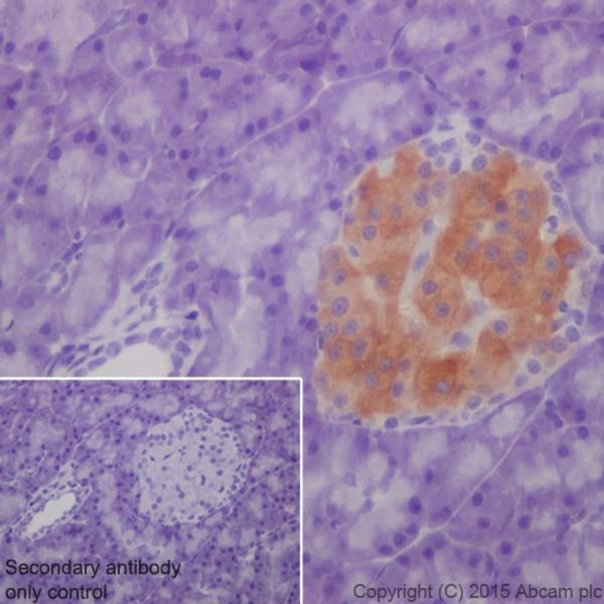 Anti-GAD65 + GAD67 Rabbit Monoclonal Antibody [clone: EPR19366] | VWR ...
