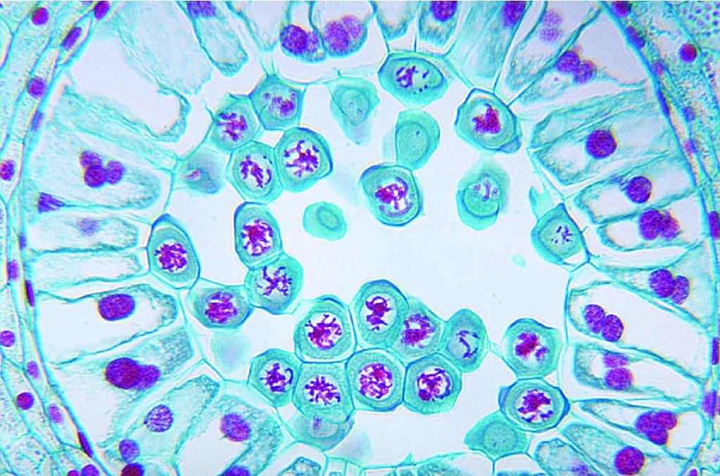 Lily Meiosis, Late Prophase Slide