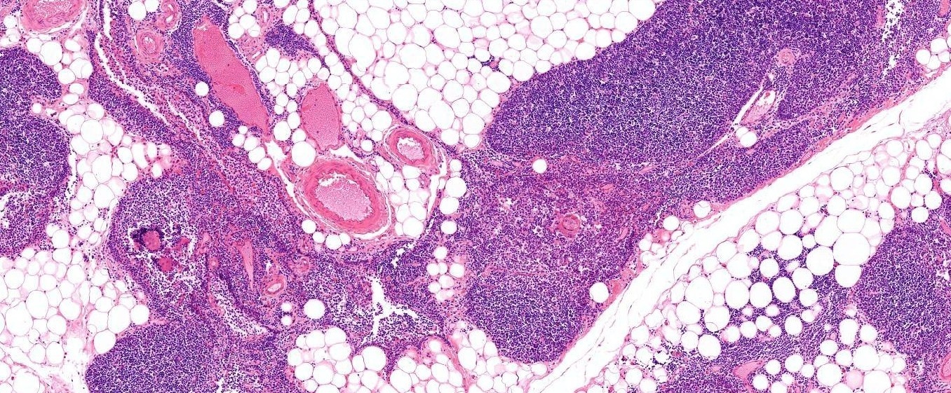 Thymus, Mammal Slide
