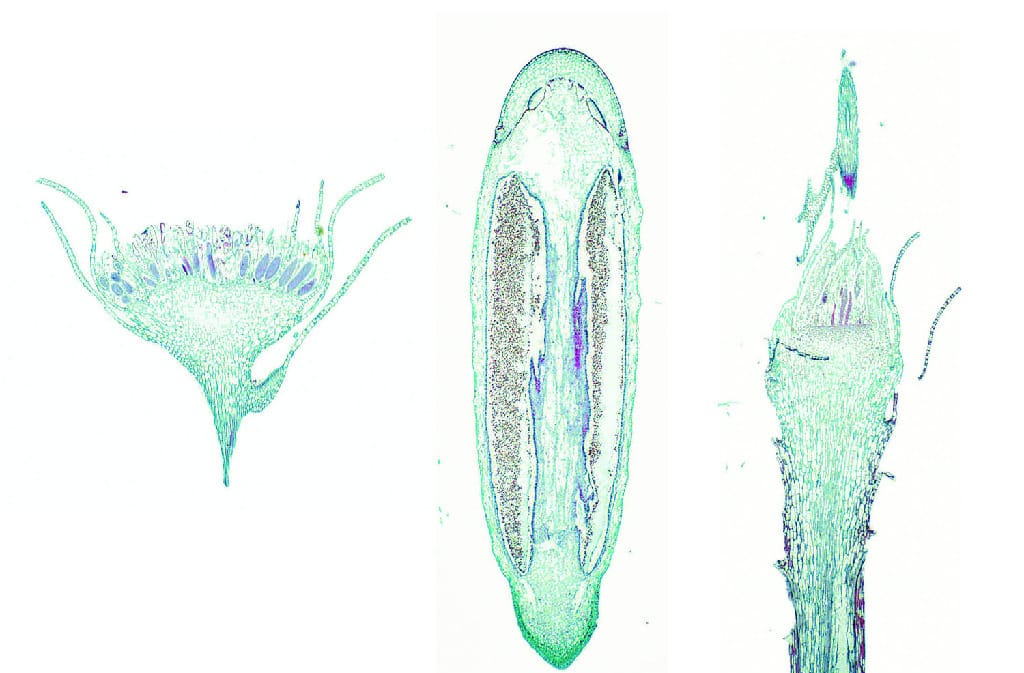 Ward's® Moss (Mnium) Slides