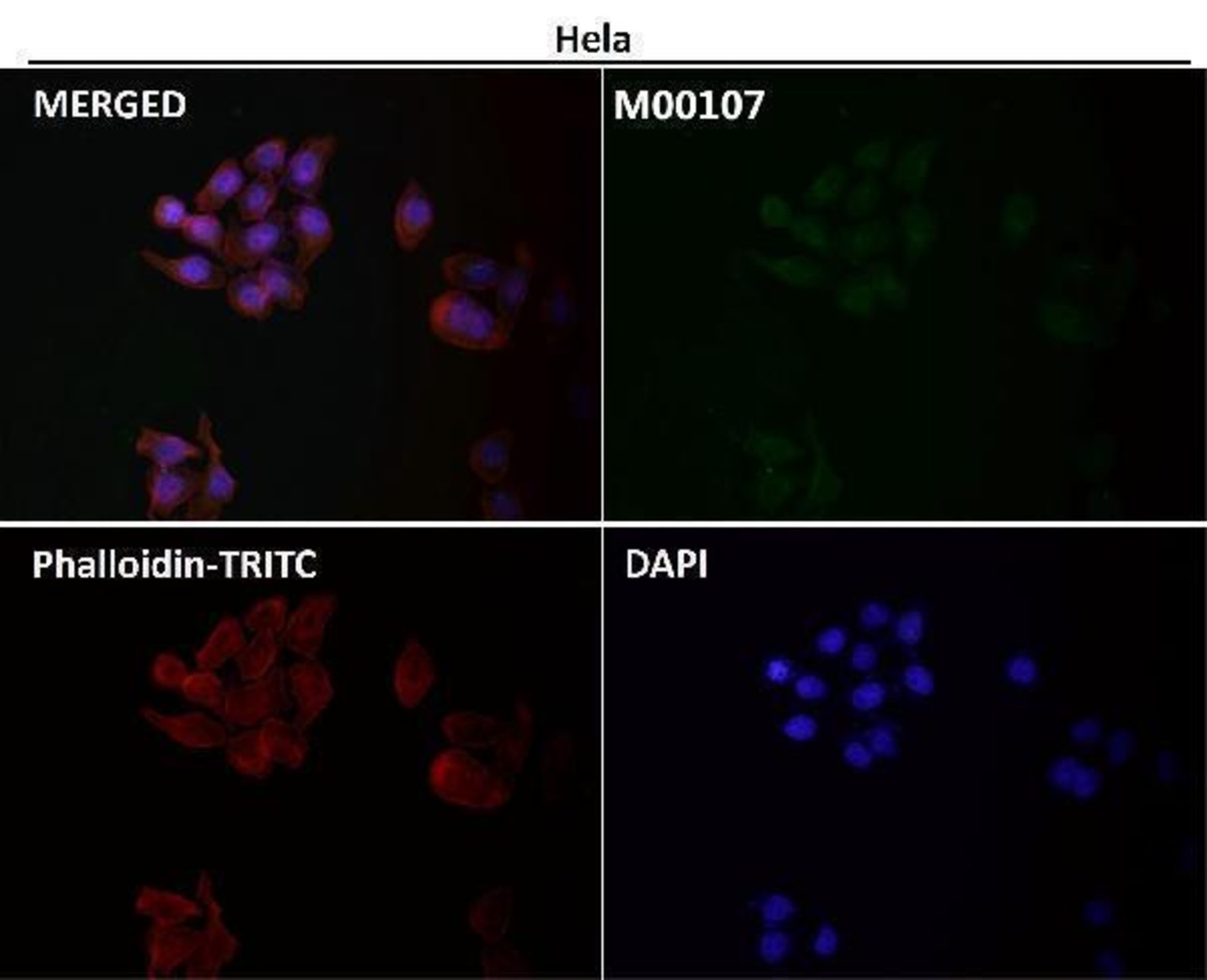 Anti-SRC Rabbit Monoclonal Antibody [clone: III-19] | VWR, part of Avantor