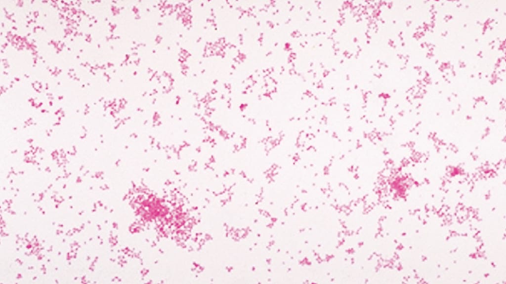 Ward's® Live Neisseria sicca Culture