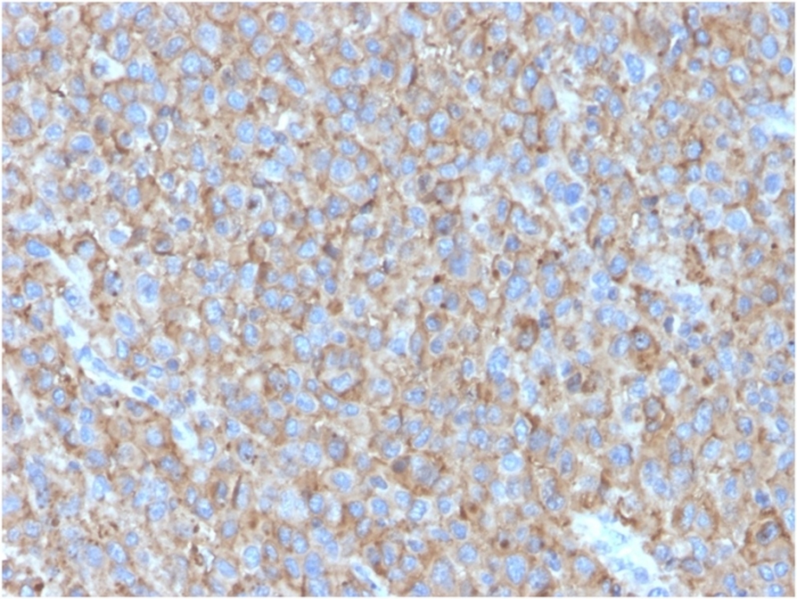 Anti-CD63 Mouse Monoclonal Antibody [clone: LAMP3/2790] | VWR, part of ...