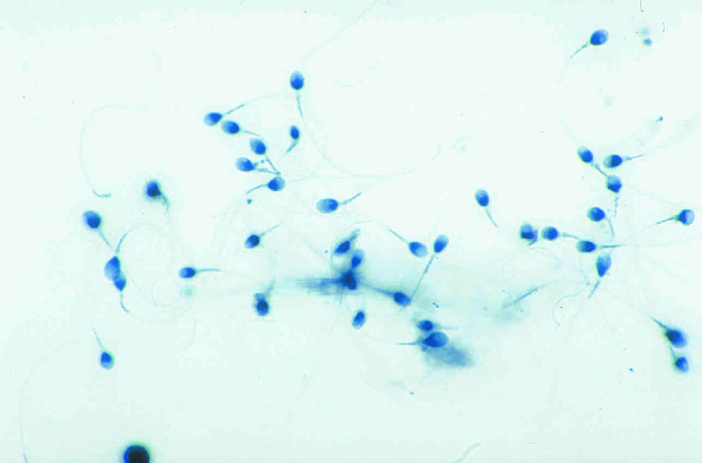 Forensic Serological Comparison Slide Set