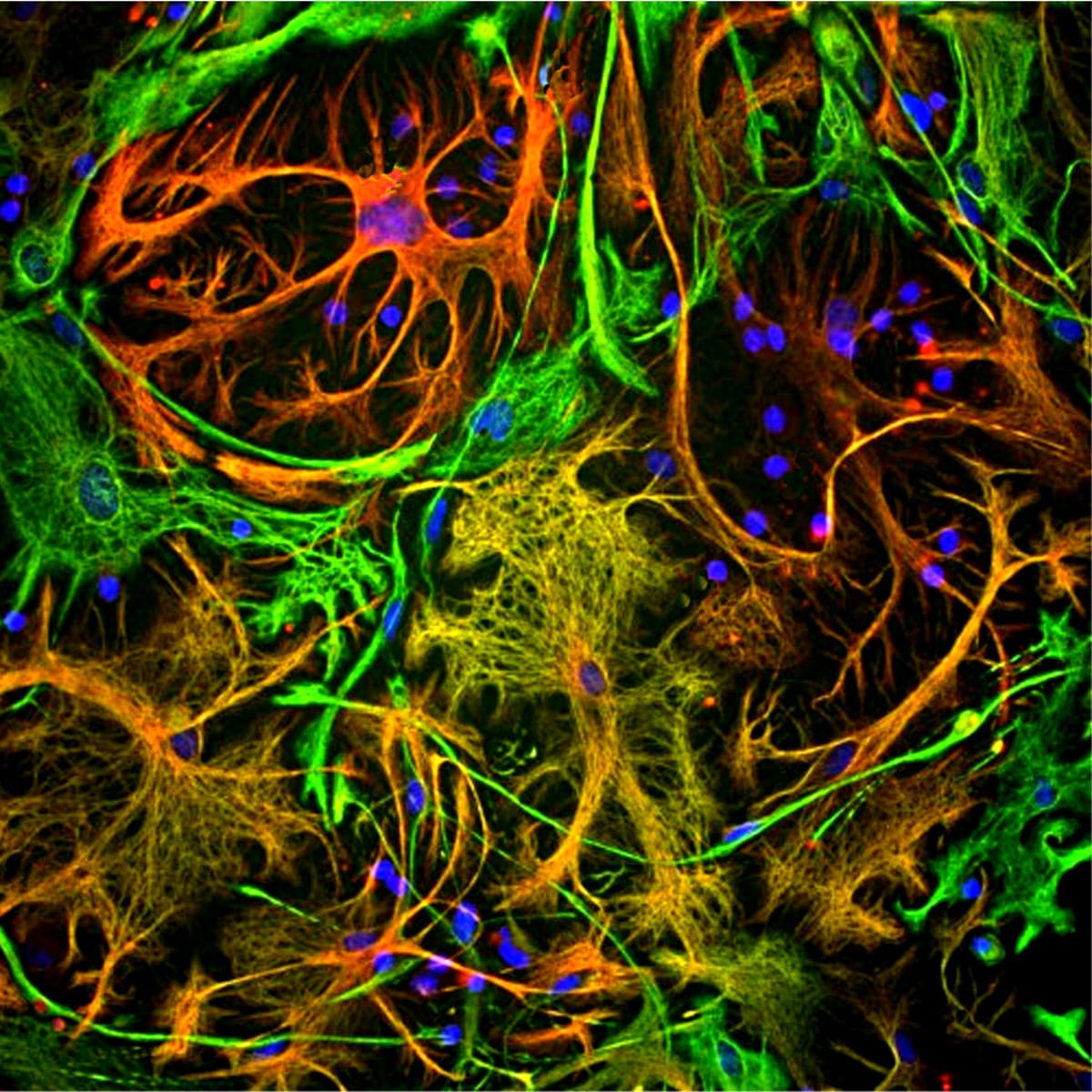 Anti-Vimentin Mouse Monoclonal Antibody [clone: 2A52] | VWR, part of ...