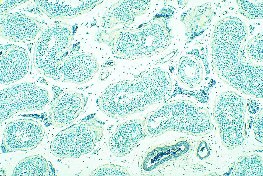 Testis, Human Slide