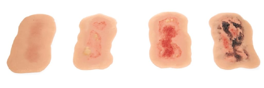 Medicor® Sticky Wounds