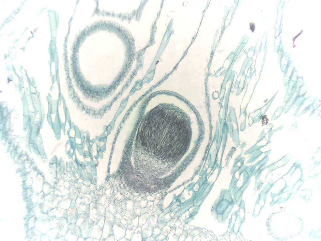 Ward's® Liverwort (Marchantia) Slides
